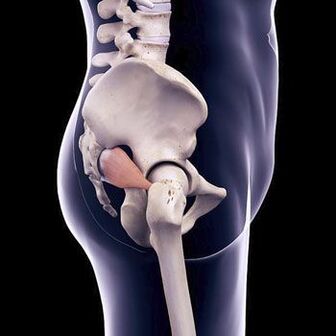 Back pain can be caused by spasm of the piriformis muscle