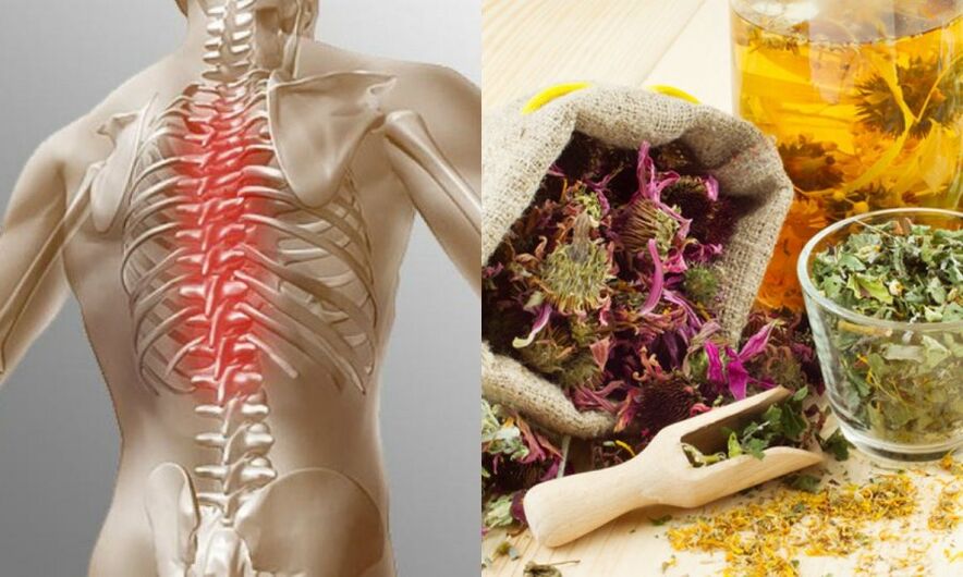 Traditional recipes - prevent the development of osteochondrosis and support the health of the spine