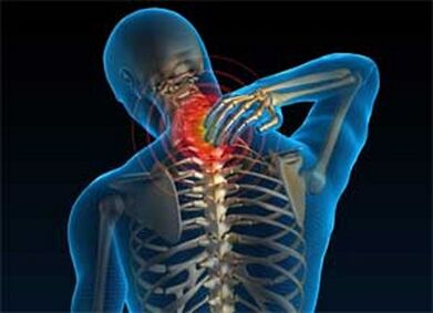Cervical pain is a common symptom of osteochondrosis