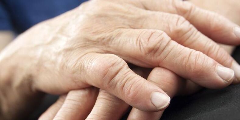 What pathologies do finger joints do